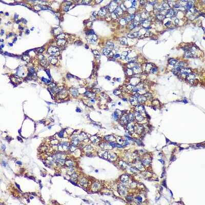 Immunohistochemistry-Paraffin: SLIRP Antibody - Azide and BSA Free [NBP2-93150]