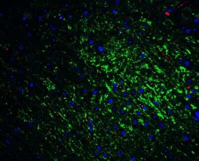 Immunohistochemistry: SLITRK1 Antibody - BSA Free [NBP1-77319]
