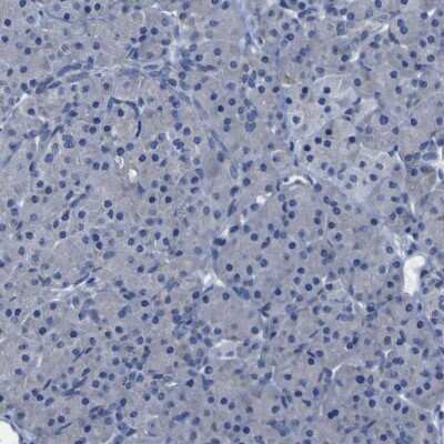 Immunohistochemistry-Paraffin: SLITRK1 Antibody [NBP1-82882]