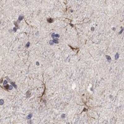 Immunohistochemistry-Paraffin: SLITRK1 Antibody [NBP3-16976]