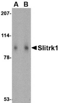 Western Blot: SLITRK1 AntibodyBSA Free [NBP1-77319]