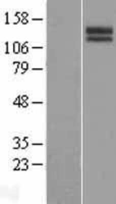 Western Blot: SLITRK3 Overexpression Lysate [NBP2-07248]