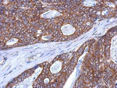 Immunohistochemistry-Paraffin: SLITRK5 Antibody [NBP2-20400]