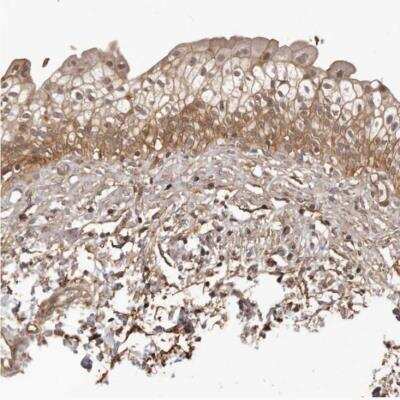 Immunohistochemistry-Paraffin: SLITRK6 Antibody [NBP1-82107]