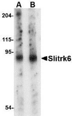 Western Blot: SLITRK6 AntibodyBSA Free [NBP1-76877]