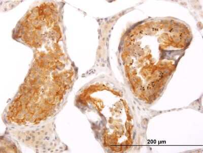 Immunohistochemistry-Paraffin: SLMAP Antibody (2A7) [H00007871-M08]