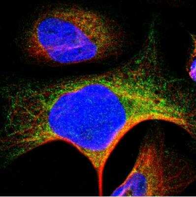 Immunocytochemistry/ Immunofluorescence: SLMAP Antibody [NBP1-81397]