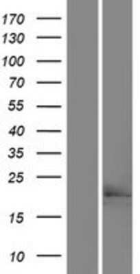 Western Blot: SLMO1 Overexpression Lysate [NBP2-07607]