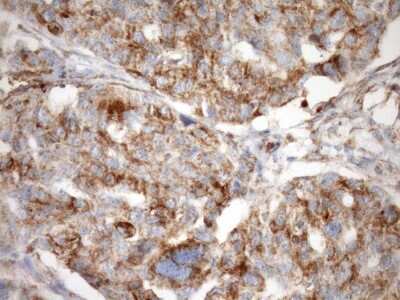 Immunohistochemistry: SLP-2 Antibody (OTI1F5) [NBP2-45464]