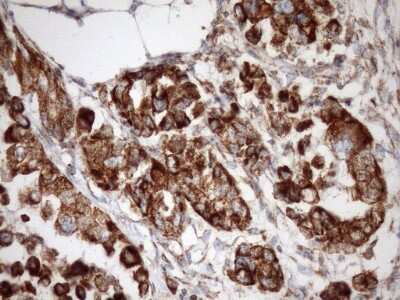 Immunohistochemistry: SLP-2 Antibody (OTI1F5) [NBP2-45464]