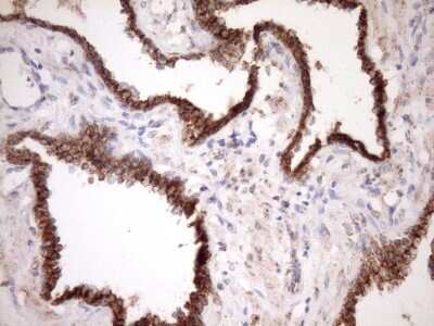 Immunohistochemistry: SLP-2 Antibody (OTI1F5) [NBP2-45464]