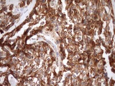 Immunohistochemistry: SLP-2 Antibody (OTI1F5) - Azide and BSA Free [NBP2-74227]