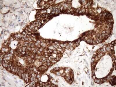 Immunohistochemistry: SLP-2 Antibody (OTI1F5) - Azide and BSA Free [NBP2-74227]