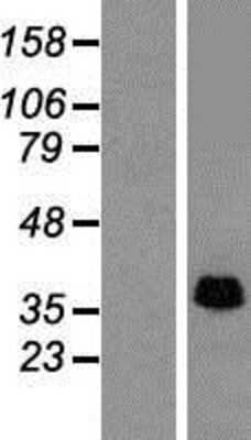 Western Blot: SLP-2 Overexpression Lysate [NBP2-10338]