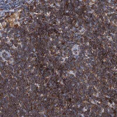 Immunohistochemistry-Paraffin: SLP-76/LCP2 Antibody [NBP1-87032]