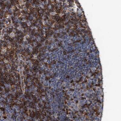 Immunohistochemistry-Paraffin: SLP-76/LCP2 Antibody [NBP1-87033]