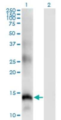 Western Blot: SLPI Antibody (3C6) [H00006590-M01]
