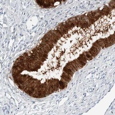 Immunohistochemistry-Paraffin: SLPI Antibody [NBP1-89139]