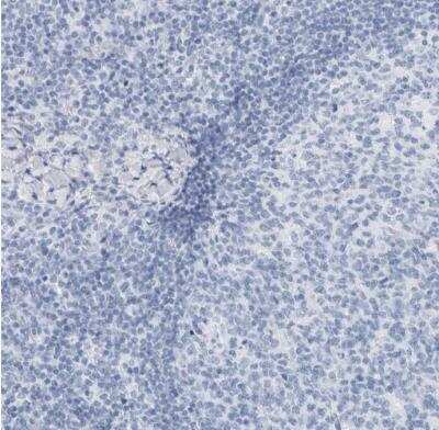 Immunohistochemistry-Paraffin: SLPI Antibody [NBP1-89139]