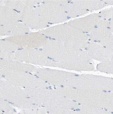 Immunohistochemistry-Paraffin: SLPI Antibody [NBP1-89139]
