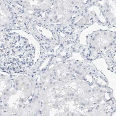 Immunohistochemistry-Paraffin: SLPI Antibody [NBP1-89139]
