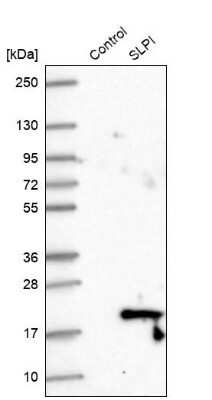 Western Blot: SLPI Antibody [NBP1-89139]