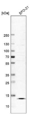 Western Blot: SLPI Antibody [NBP1-89139]