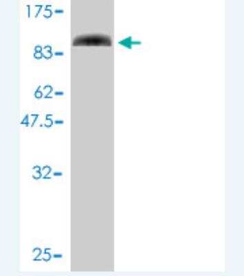 Western Blot: SLU7 Antibody (1D3-4A10) [H00010569-M01]