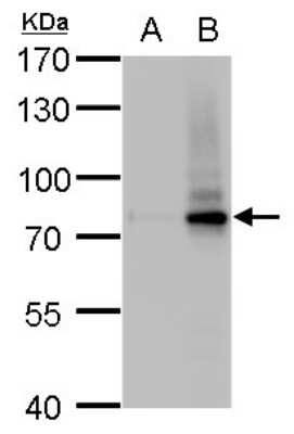 Western Blot: SLU7 Antibody (262) [NBP2-43793]