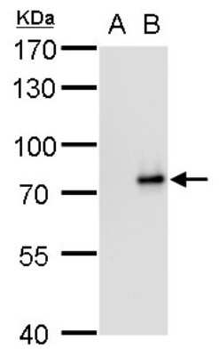 Western Blot: SLU7 Antibody (759) [NBP2-43794]