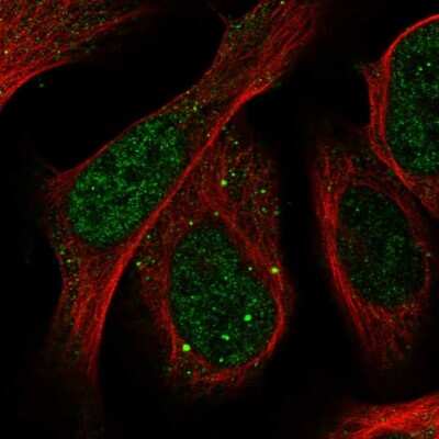 Immunocytochemistry/ Immunofluorescence: SLU7 Antibody [NBP1-89343]