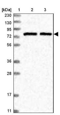 Western Blot: SLU7 Antibody [NBP1-89343]