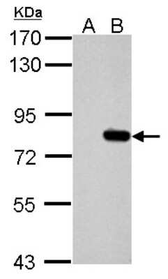 Western Blot: SLU7 Antibody [NBP2-20402]