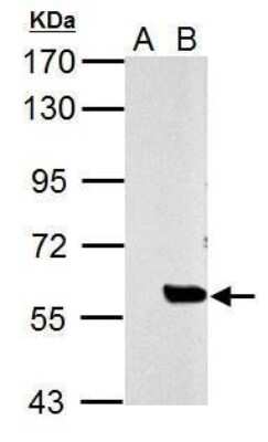 Western Blot: SLU7 Antibody [NBP2-42921]