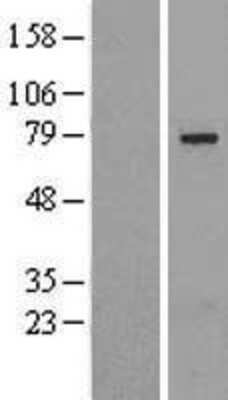 Western Blot: SLU7 Overexpression Lysate [NBL1-16216]