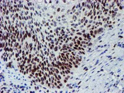 Immunohistochemistry-Paraffin: Slug Antibody (OTI1A6) [NBP2-03886]
