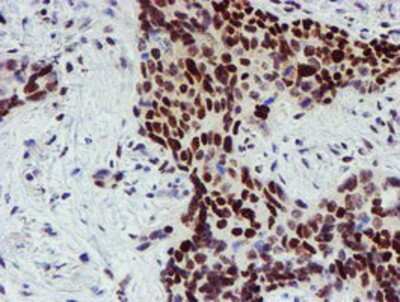 Immunohistochemistry-Paraffin: Slug Antibody (OTI1A6) [NBP2-03886]