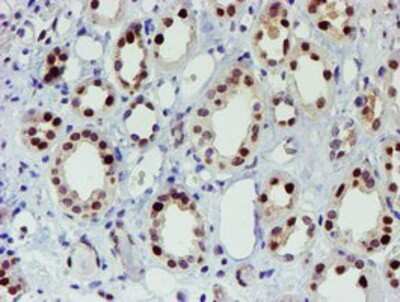 Immunohistochemistry-Paraffin: Slug Antibody (OTI1A6) [NBP2-03886]