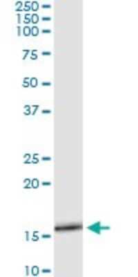 Immunoprecipitation: SLURP1 Antibody (4D1) [H00057152-M06]