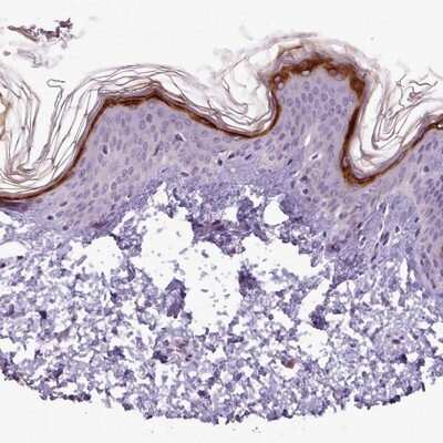 Immunohistochemistry-Paraffin: SLURP1 Antibody [NBP2-13351]