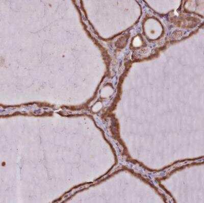 Immunohistochemistry-Paraffin: SLX1A Antibody [NBP2-54733]