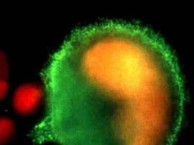 Immunocytochemistry/ Immunofluorescence: SM047 Antibody (SM047) [NBP1-97921]