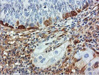 Immunohistochemistry-Paraffin: Transgelin/TAGLN/SM22 alpha Antibody (OTI8C8) [NBP2-00894]