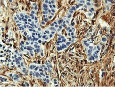 Immunohistochemistry-Paraffin: Transgelin/TAGLN/SM22 alpha Antibody (OTI8C8) [NBP2-00894]