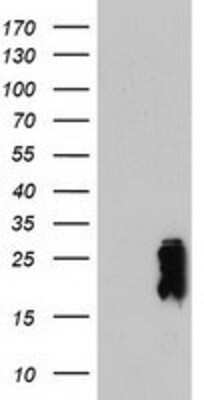 Western Blot: Transgelin/TAGLN/SM22 alpha Antibody (OTI8C8) [NBP2-00894]