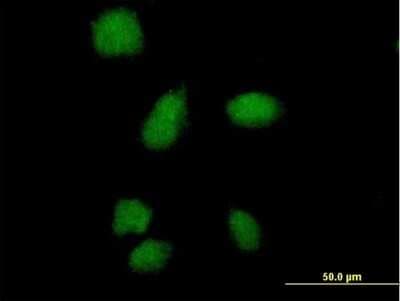 Immunocytochemistry/ Immunofluorescence: SMA4 Antibody [H00011039-B01P]