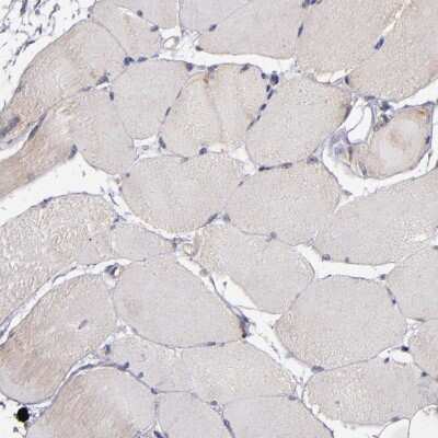 Immunohistochemistry-Paraffin: SMAC/Diablo Antibody [NBP1-84262]