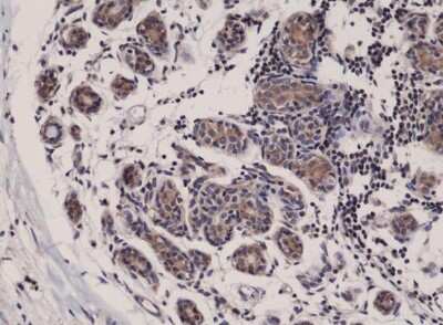 Immunohistochemistry-Paraffin: SMAC/Diablo Antibody (RM271) [NBP2-61586]