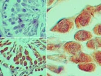Immunohistochemistry-Paraffin: Smad2 Antibody [NB100-56462]
