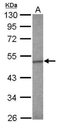 Western Blot: Smad5 Antibody [NBP2-20413]